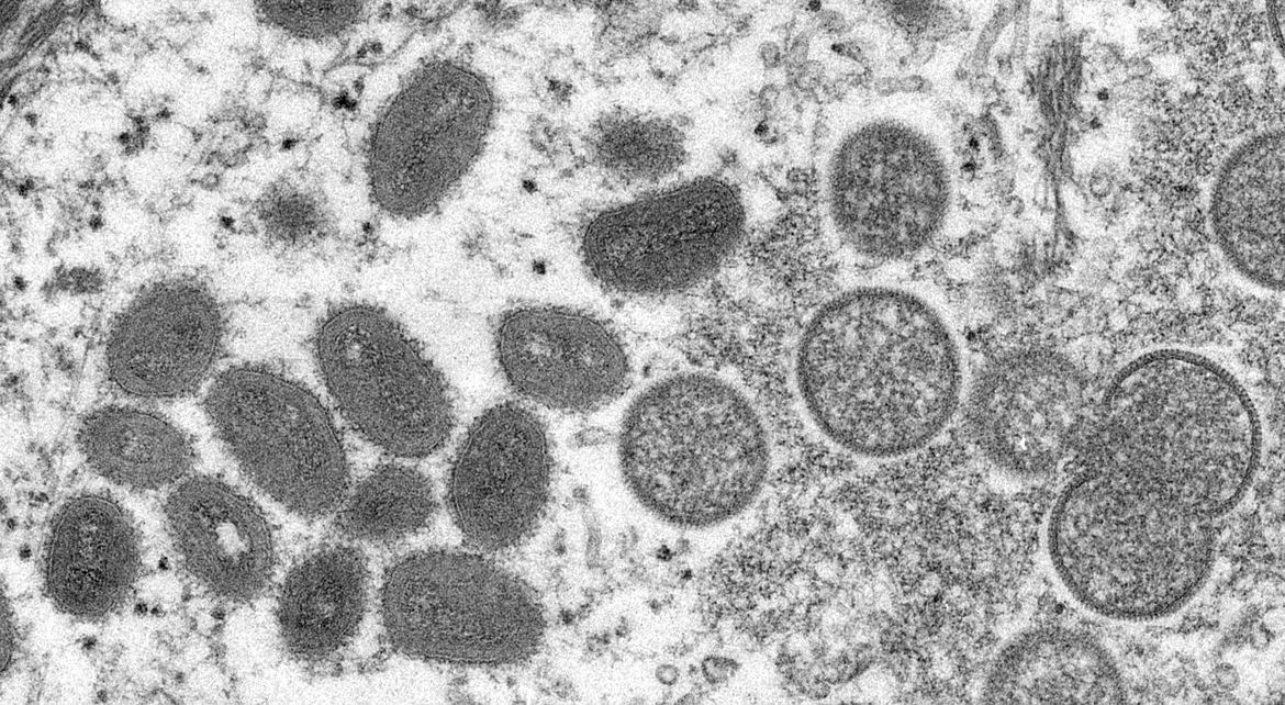 Brasil tem mais de 200 casos confirmados de varíola dos macacos - Foto: Reprodução
