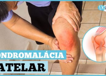 Foto: Reprodução/Canal Doutor Ajuda