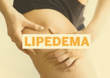Lipedema: mais de 10 milhões de brasileiras podem ter a doença e não sabem - Foto: Brasil 61