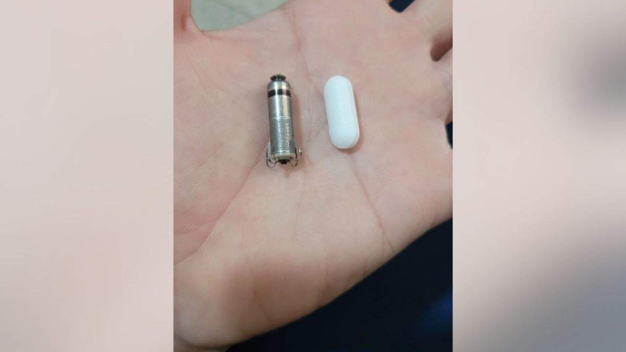 Aposentado recebe o menor marca-passo do mundo em Colatina - Foto: Divulgação/ Hospital São Bernardo
