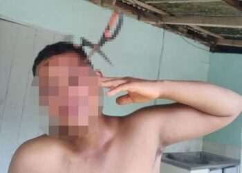 Adolescente fica gravemente ferido após ser atingido por tesoura em Pancas - Foto: Reprodução