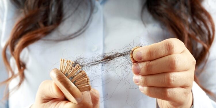 Alopecia: causas, impactos e o Mega Hair como alternativa - Foto Pexels