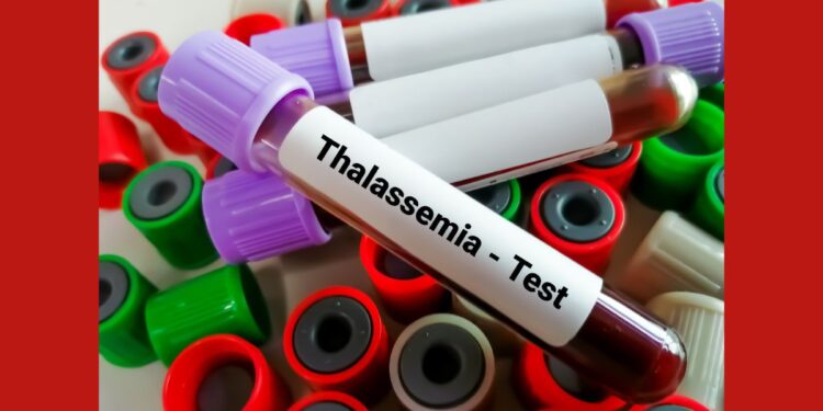 Dia Internacional da Talassemia: teste do pezinho ajuda a diagnosticar precocemente - Foto: Divulgação