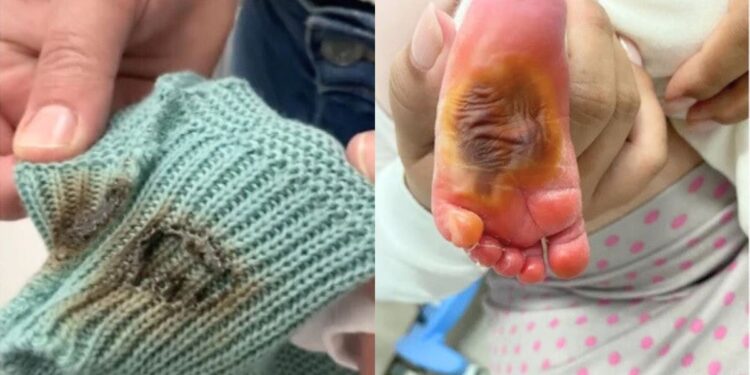 Queimadura de bebê em hospital estadual do ES é investigada pelo MPES - Foto: Reprodução