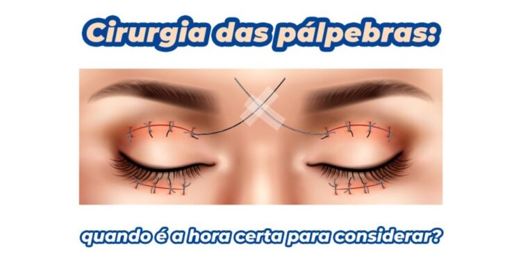 Cirurgia das pálpebras: especialista explica quando a blefaroplastia é indicada. Foto: reprodução