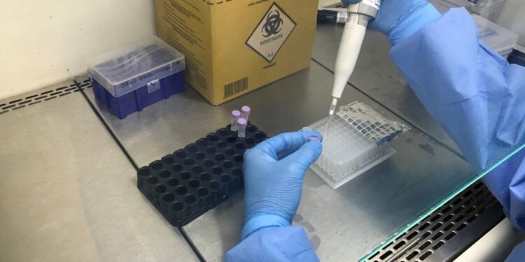 INFECÇÃO MISTERIOSA – Sesa descarta Covid-19; orientações de caso suspeito chegam a Linhares e Colatina. Veja nota completa. - Foto: SESA