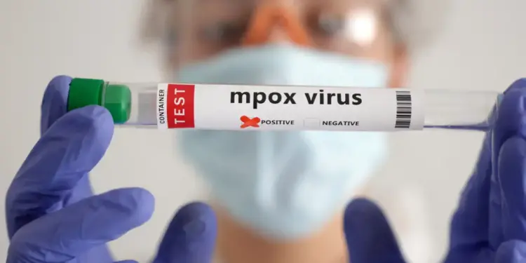 Secretaria de Saúde confirma segundo caso de mpox do grupo lp em SP - Foto: REUTERS/Dado Ruvic/Proibida reprodução