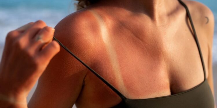 Bronzeamento artificial: os perigos para a pele e como se proteger - Foto: Freepik