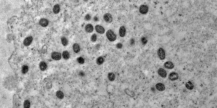 Paciente apresentou sintomas em dezembro de 2025 na capital paulista; estado já soma 33 notificações em 2026, sem registro de óbitos associados - Imagem: Débora F. Barreto-Vieira/IOC/Fiocruz