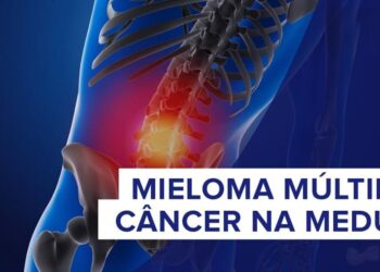 Março Borgonha: mieloma múltiplo é câncer do sangue que pode causar fraturas e comprometer os rins - Imagem: Divulgação