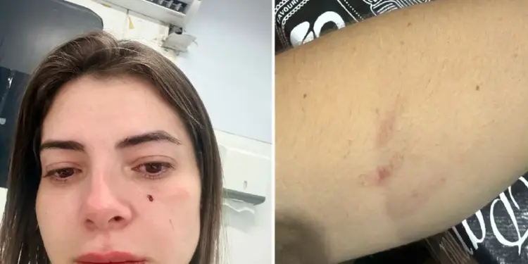 Pediatra é agredida com mordidas e socos por mãe de paciente em UPA de Macaé (RJ)
